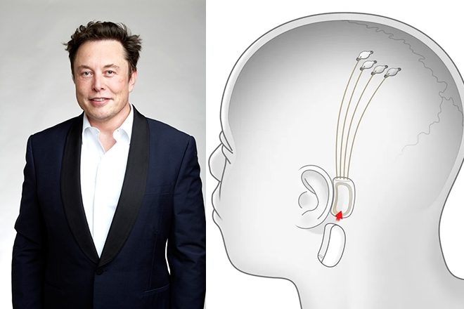 musk:-brenda-6-muajve-do-vendosim-cipin-e-pare-ne-trurin-njeriut