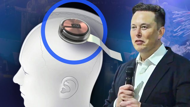 elon-musk:-cipi-i-trurit-do-te-testohet-te-njerezit-per-6-muaj