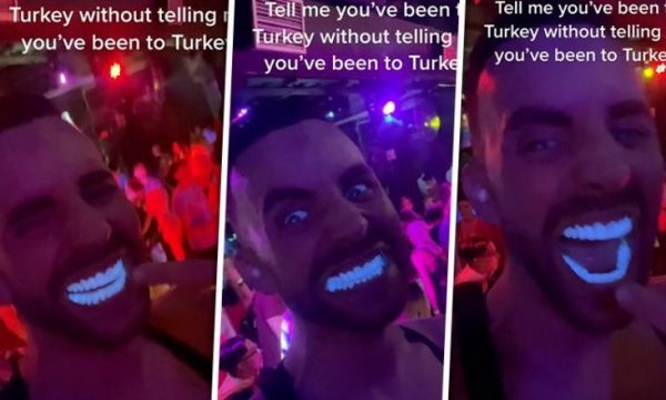 rregulloi-dhembet-ne-turqi,-video-e-te-riut-behet-virale-ne-rrjetet-sociale