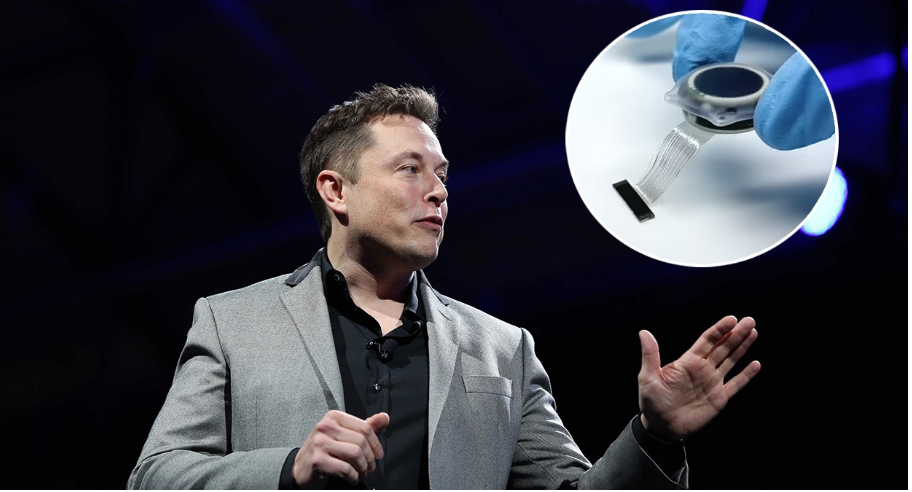 si-funksionon-dhe-sa-i-sigurt-eshte-cipi-i-trurit-i-projektuar-nga-elon-musk?