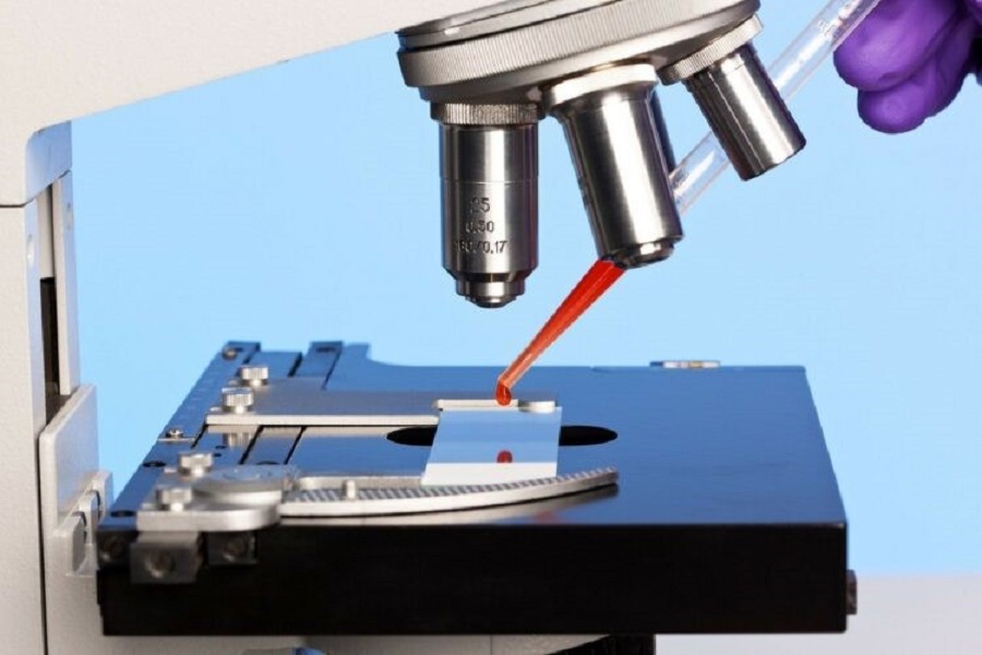 obsh:-disa-baktere-ne-gjak-u-bene-rezistuese-ndaj-te-gjithe-antibiotikeve-ne-vitin-2020