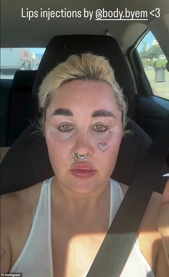 amanda-bynes-shfaq-pamjen-e-re-pas-nderhyrjeve-kozmetike-dhe-humbjes-se-peshes